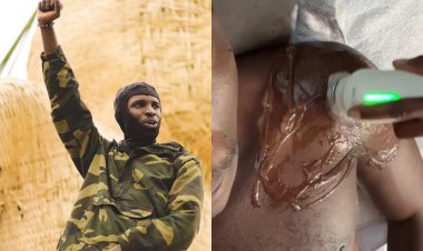 Amafoto: Ish Kevin umaze iminsi yaravunitse ari koroherwa