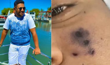 Igitagangurirwa cyivuganye umuhanzi muri Brazil