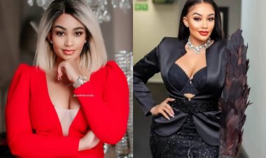 Zari yahishuye ikiguzi byamutwaye yibagisha agamije ubwiza