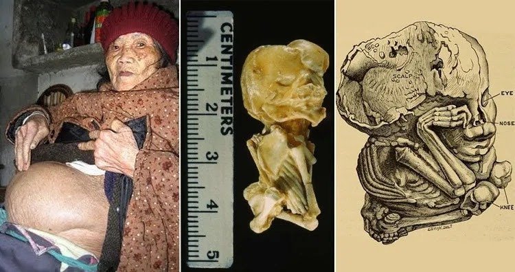 Wari uzi ko hari umugore watwaye inda imyaka 60?